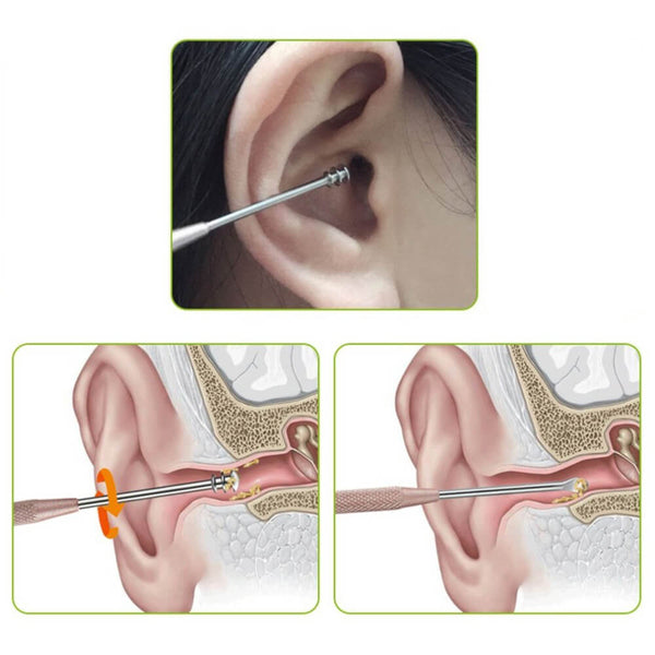 Cure oreille inox utilisation